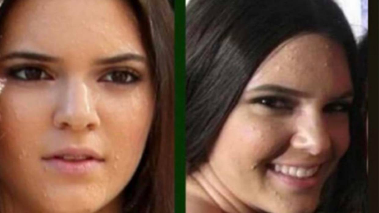 Kendall Jenner gives us much more on her acne hell