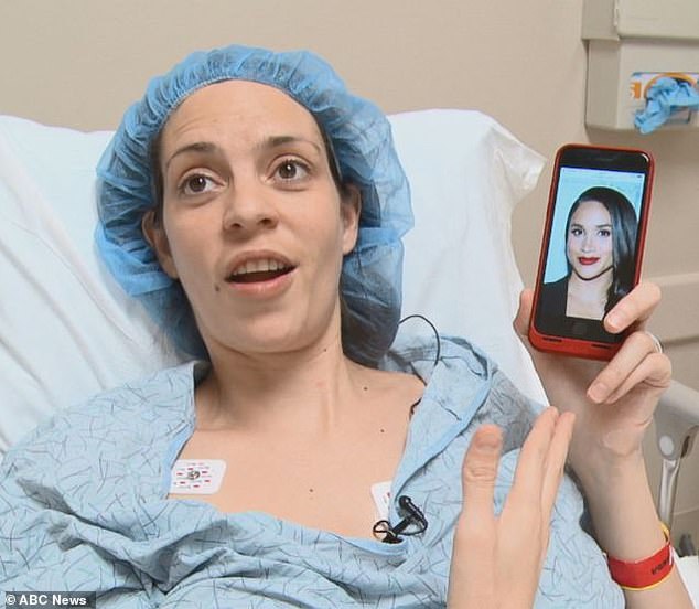Meghan Markle wannabe mum-of-3 spends £19k on plastic surgery to look like idol