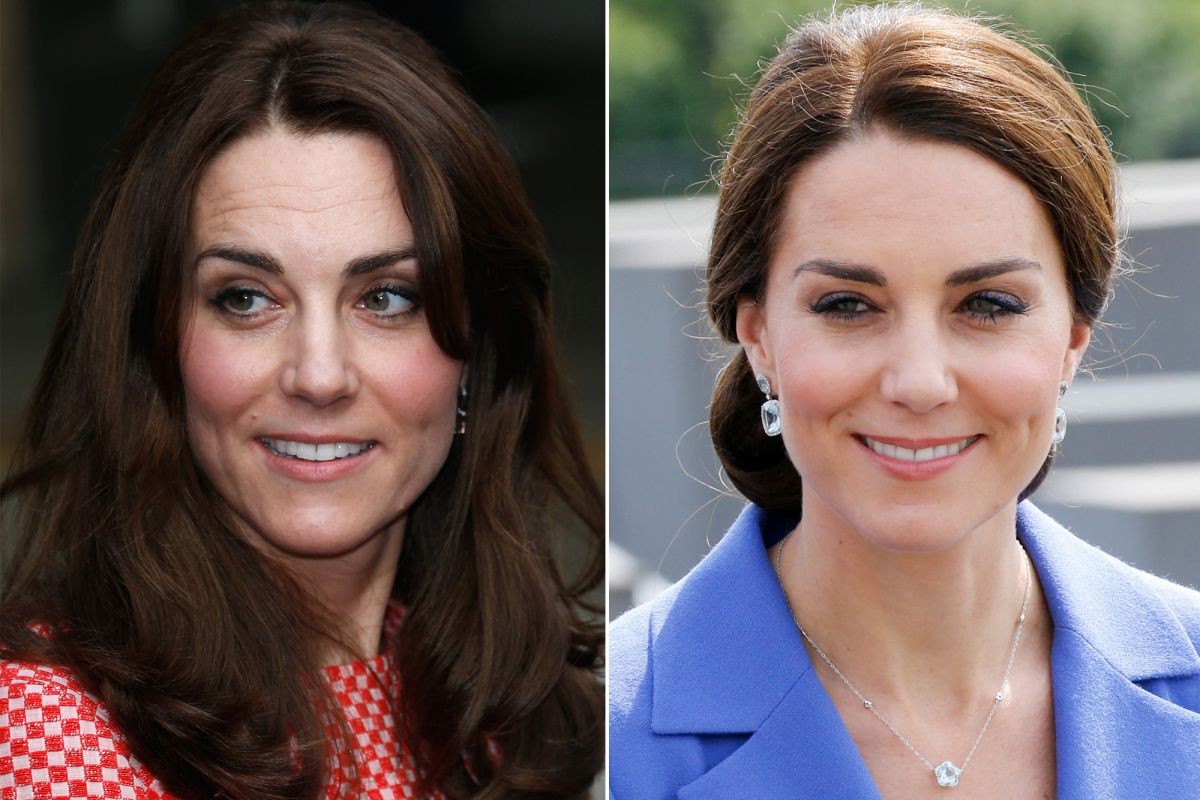 Kensington Palace Shuts Down Rumors Saying Kate Middleton Got "Baby Botox"